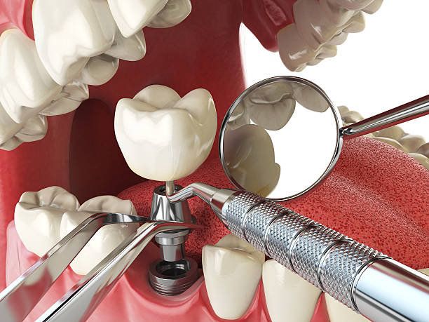 Best Same-Day Emergency Dental Services in Lowell, MI